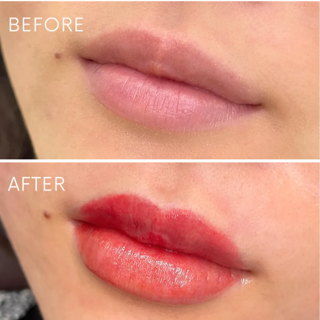 リップアートメイクの症例写真_02