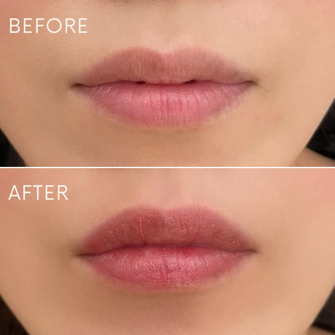 リップアートメイクの症例写真_03