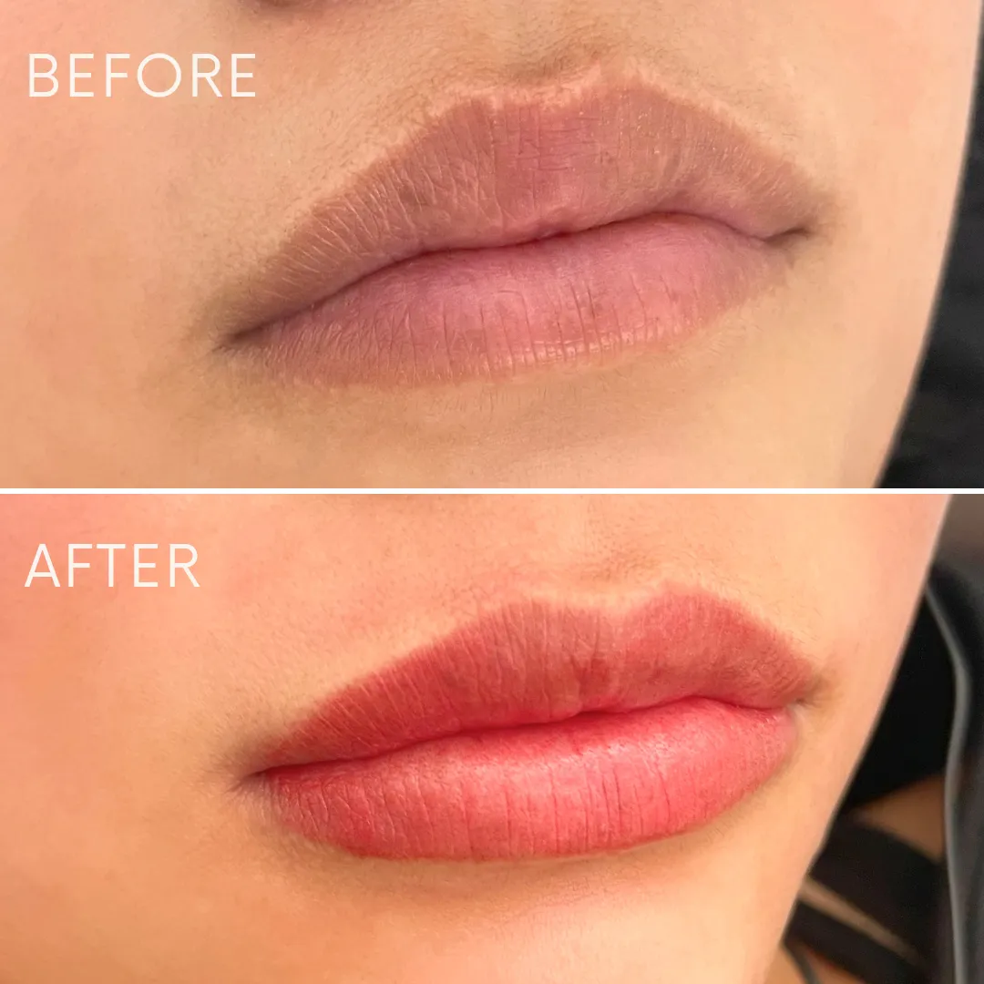 リップアートメイクの症例写真_04