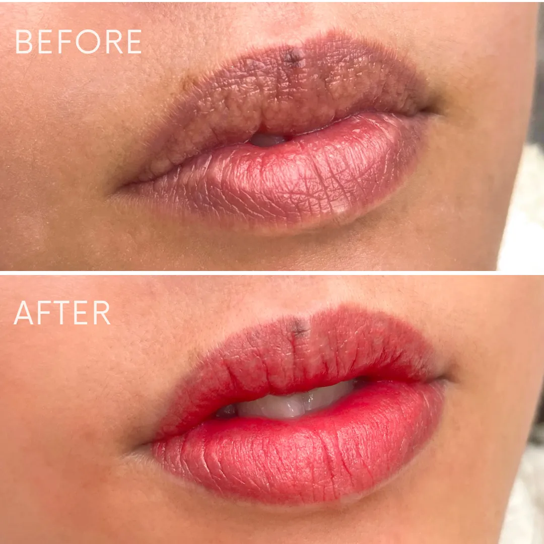 リップアートメイクの症例写真_06