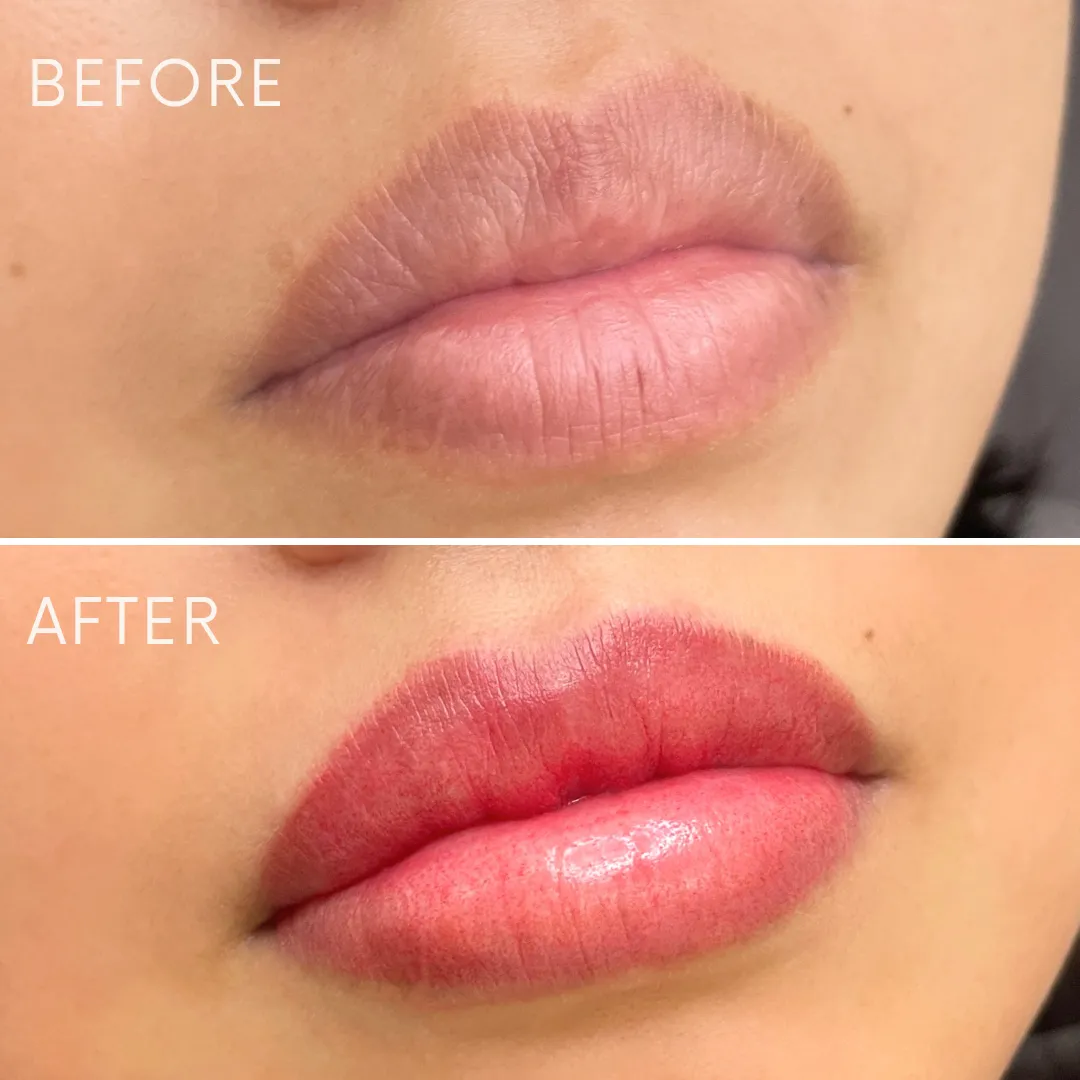 リップアートメイクの症例写真_07