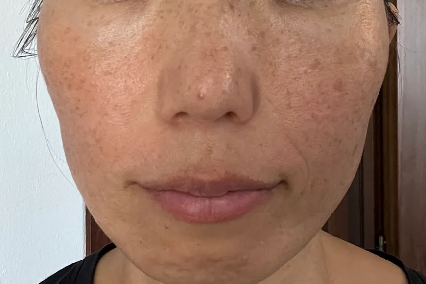 セラピューティックPHASE 0