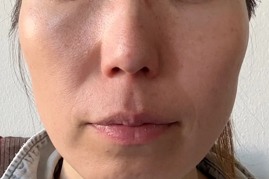 セラピューティックPHASE 4