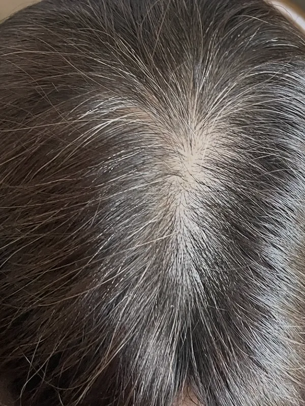 ルグゼバイブ3ヶ月継続後