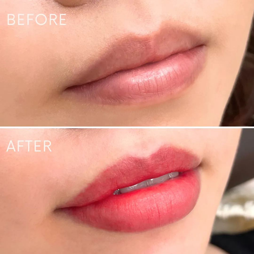 リップアートメイクの症例写真_08