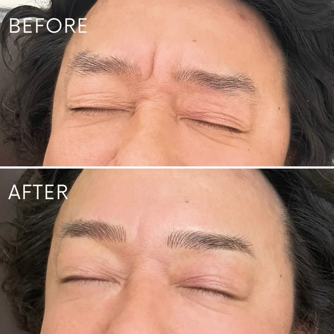 メンズアートメイクの症例_06