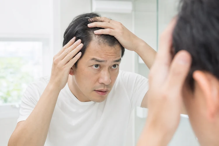 抜け毛を気にして生え際を確認する男性